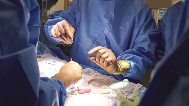 Американские хирурги впервые успешно пересадили человеку почку свиньи