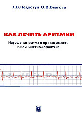 Как лечить аритмии