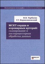 МСКТ сердца и коронарных артерий: сканирование и постпроцессорная обработка данных