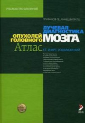 Лучевая диагностика опухолей головного мозга. Атлас КТ и МРТ-изображений