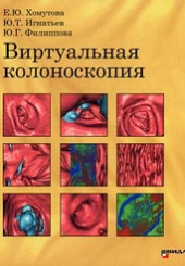 Виртуальная колоноскопия