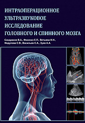 Интраоперационное ультразвуковое исследование головного и спинного мозга