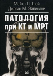 Патология при КТ и МРТ 