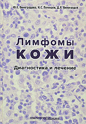 Лимфомы кожи: диагностика и лечение