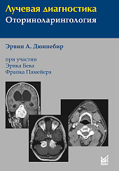 Лучевая диагностика: оториноларингология 