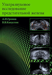 Ультразвуковое исследование предстательной железы