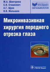 Микроинвазивная хирургия переднего отрезка глаза