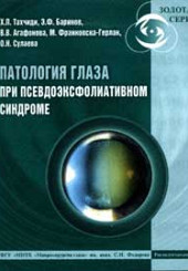 Патология глаз при псевдоэксфолиативном синдроме.