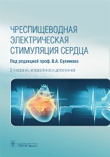 Чреспищеводная электрическая стимуляция сердца