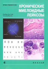 Хронические миелоидные лейкозы Атлас-справочник