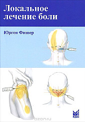 Локальное лечение боли 