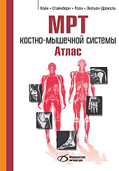 МРТ костно-мышечной системы. Атлас 