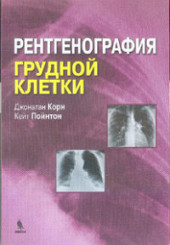 Рентгенография грудной клетки 