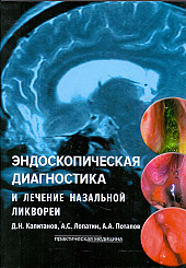 Эндоскопическая диагностика и лечение назальной ликвореи