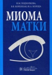 Миома матки.