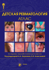 Детская ревматология. Атлас