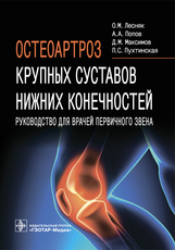 Остеоартроз крупных суставов нижних конечностей