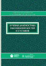 Лучевая диагностика заболеваний костей и суставов. Национальное руководство