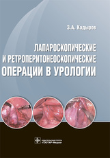 Лапароскопические и ретроперитонеоскопические операции в урологии