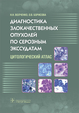 Диагностика злокачественных опухолей по серозным экссудатам. Цитологический атлас