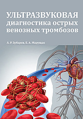 Ультразвуковая диагностика острых венозных тромбозов+CD