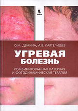 Угревая болезнь. Комбинированная лазерная и фотодинамическая терапия