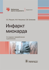 Инфаркт миокарда