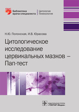 Цитологическое исследование цервикальных мазков - ПАП-тест