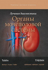 Лучевая диагностика. Органы мочеполовой системы 