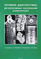 Лучевая диагностика дегенеративных заболеваний позвоночника