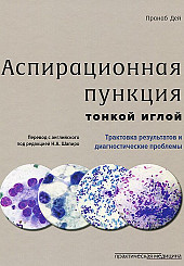 Аспирационная пункция тонкой иглой. Трактовка результатов и диагностические проблемы