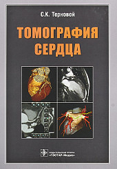 Томография сердца