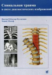 Спинальная травма в свете диагностических изображений