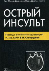 Острый инсульт