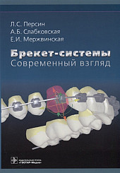 Брекет-системы. Современный взгляд