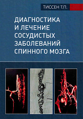Диагностика и лечение сосудистых заболеваний спинного мозга