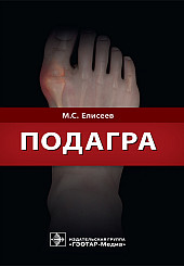 Подагра