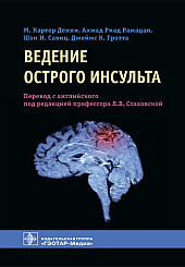 Ведение острого инсульта