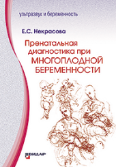 Пренатальная диагностика при многоплодной беременности.