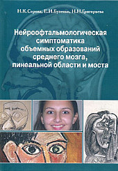 Нейроофтальмологическая симптоматика объемных образований среднего мозга, пинеальной области и моста