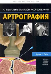 Артрография. Серия "Специальные методы исследования"