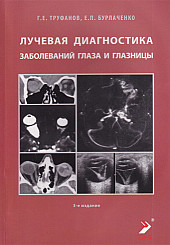 Лучевая диагностика заболеваний глаза и глазницы. Конспект лучевого диагноста