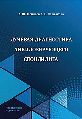 Лучевая диагностика анкилозирующего спондилита