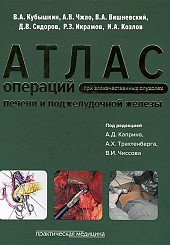 Атлас операций при злокачественных опухолях печени и поджелудочной железы (билиопанкретодуоденальной зоны)