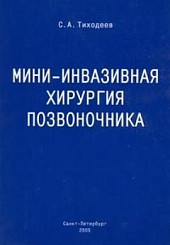 Мини-инвазивная хирургия позвоночника