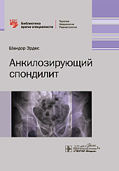 Анкилозирующий спондилит. Библиотека врача-специалиста