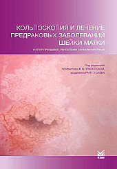 Кольпоскопия и лечение предраковых заболеваний шейки матки