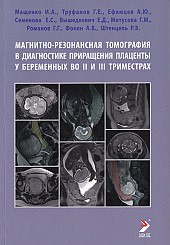 Магнитно-резонансная томография в диагностике приращения плаценты у беременных во II и III триместрах