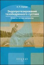 Эндопротезирование тазобедренного сустава: ответы на все вопросы
