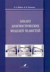 Анализ диагностических моделей челюстей